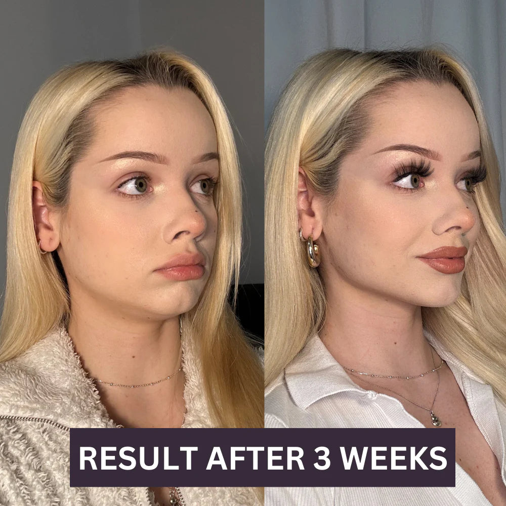 Shiny V-Shape™ - For your GLOW UP!
