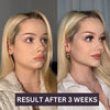 Shiny V-Shape™ - For your GLOW UP!